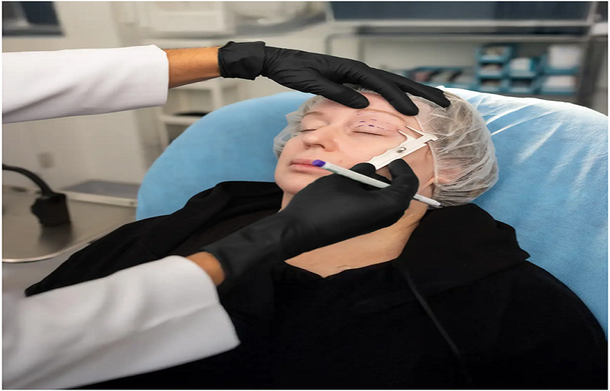 Facial lesion removal